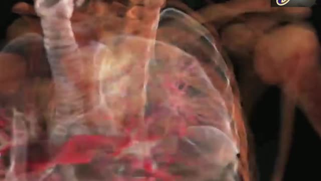 WHAT IS CANCER? WHAT CAUSES CANCER AND HOW IT IS TREATED