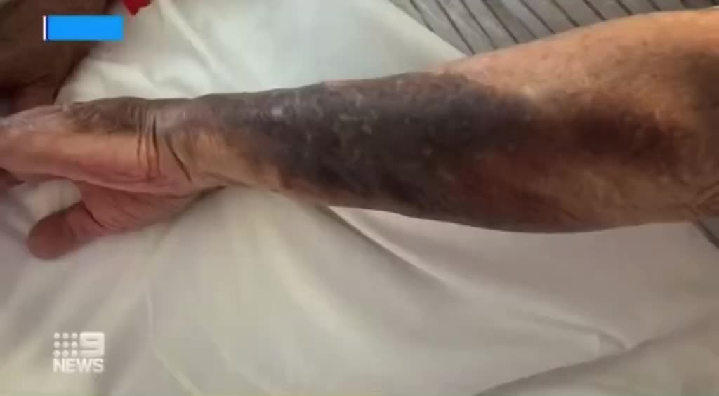 Mainstream news: Side Effects After Taking the Covid Shot.