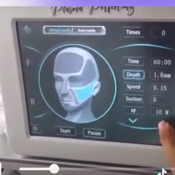 Introducing the microneedling sectional RF machine