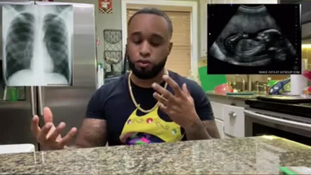 Confirm Dog Pregnancy From Home 🏠🤔⁉️ (Relaxin Test)💉