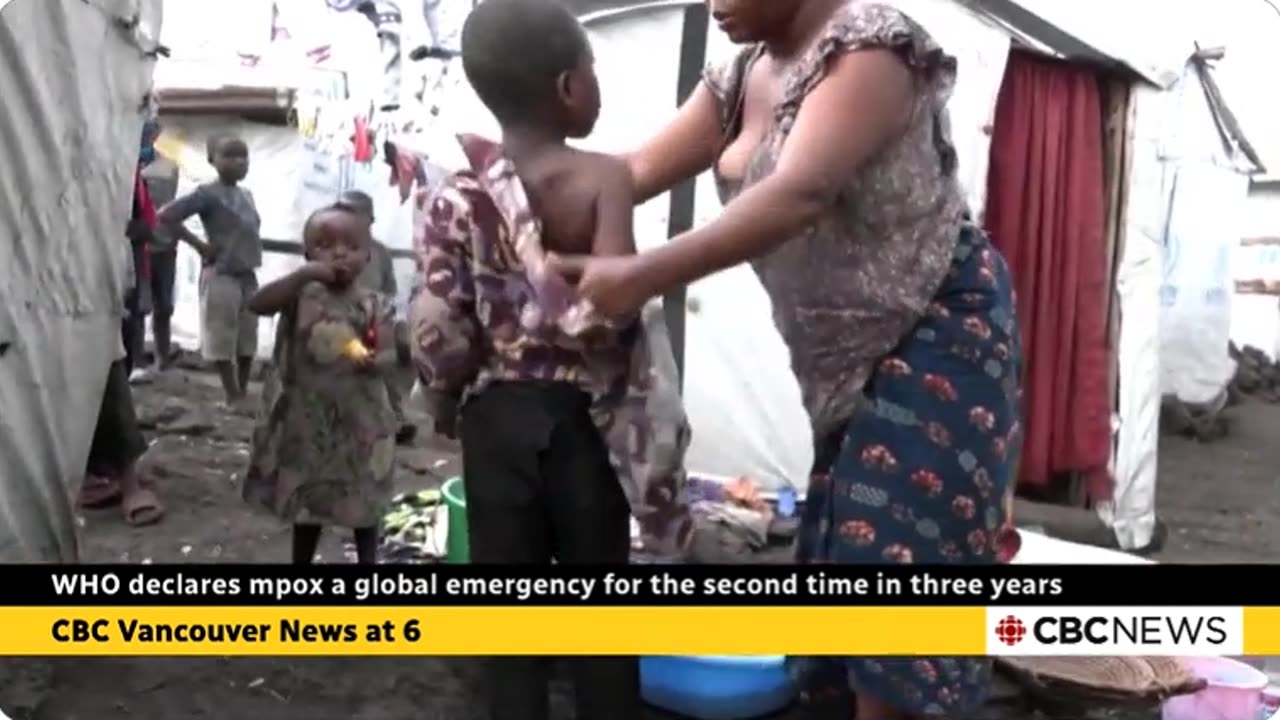 WHO Declares MPox a Global Emergency for the Second Time in Three Years