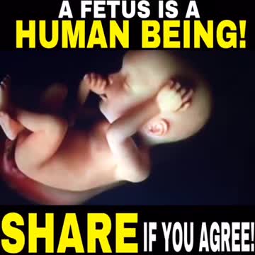 A FETUS is a Human Being