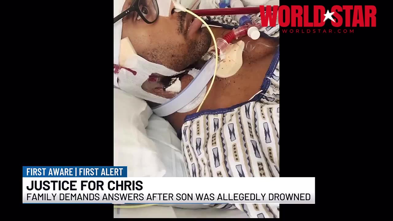 Aspiring Doctor Left Braid-Dead After Friends Pushed Him Into