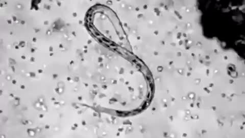 white blood cells attacking a parasite