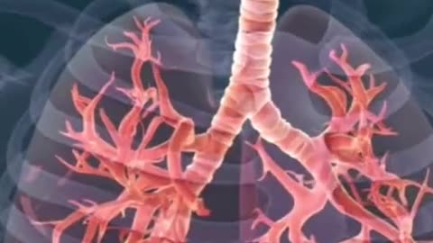 蓖麻油能分解囊腫 子宮肌瘤 腫瘤 腎結石 膽結石 骨刺