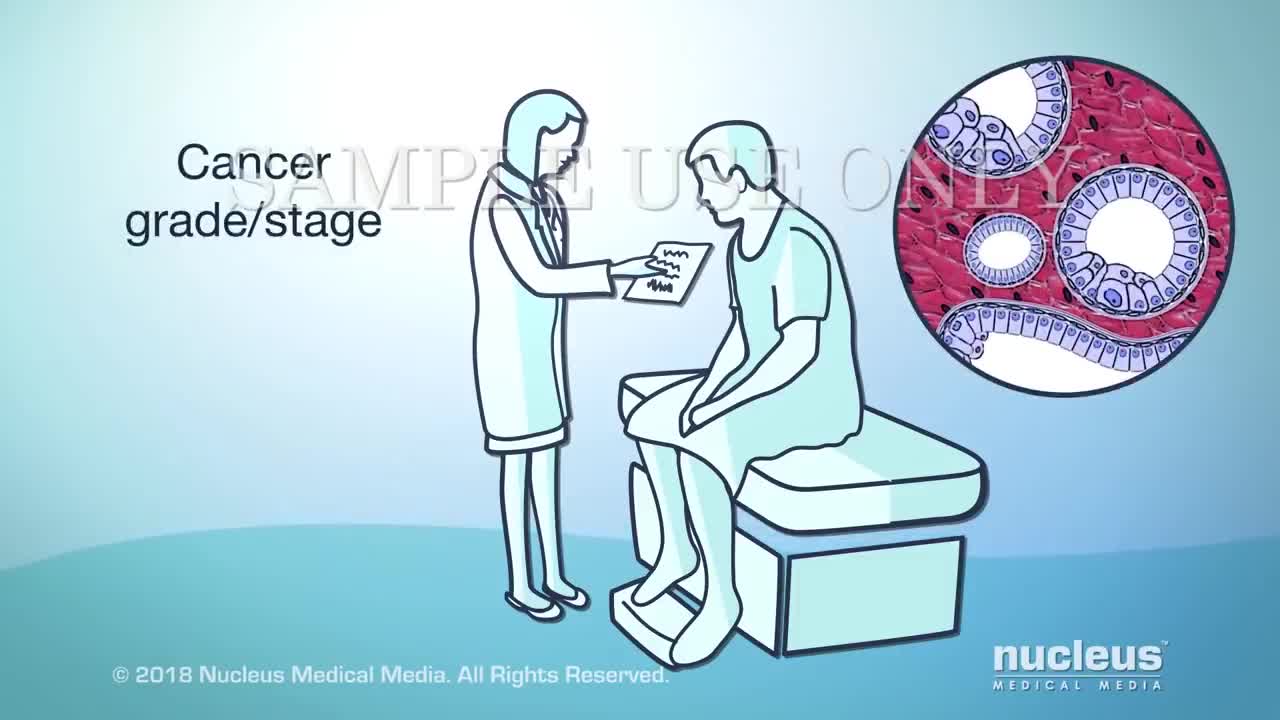 Prostate Cancer Treatment