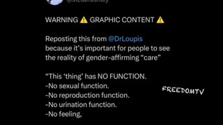 What gender affirming “care” really looks like