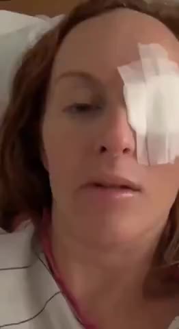 v shot damaged We Are Going to Drill a Hole in Your Head to Help You