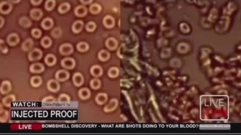 ENG vakcinetu cilveku asinis BLOOD after vaccine covid