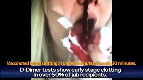 More Vaccines related Athelites deaths!