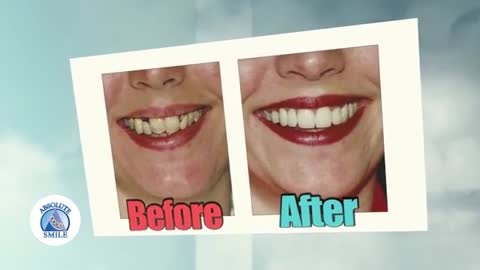 Transform Your Smile With Absolute Smile Dental Office Philadelphia