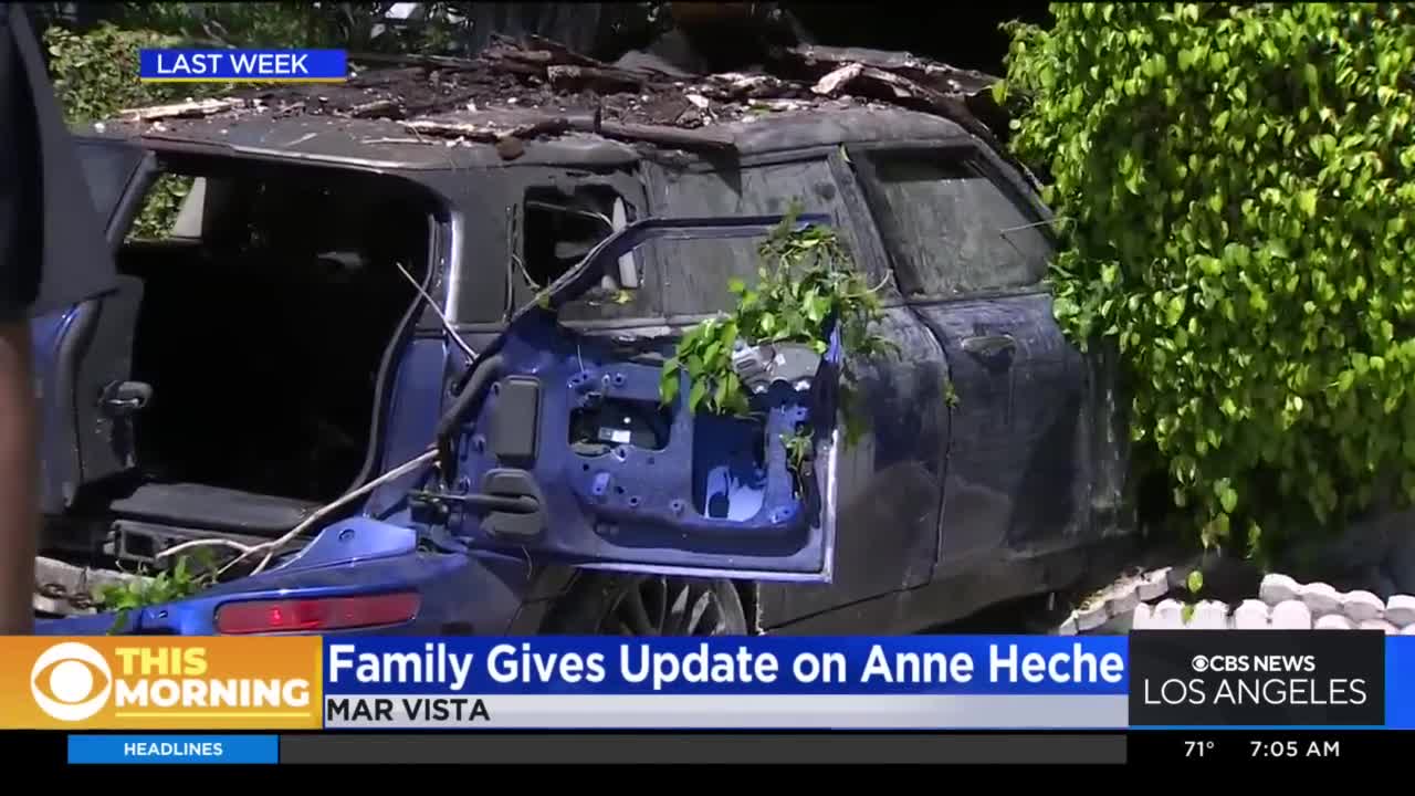 Actress Anne Heche, 53, dead after suffering brain injury in Mar Vista crash