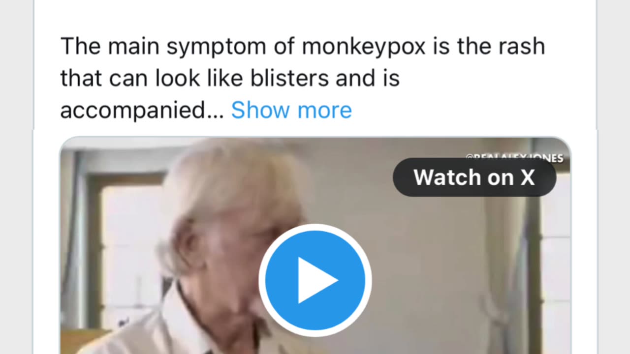 Top Doctor Blows Whistle: Monkeypox Is a Side Effect of Covid 'Vaccines