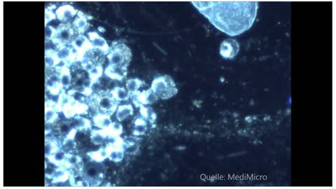 Spirochetes under the Darkfield Microscope