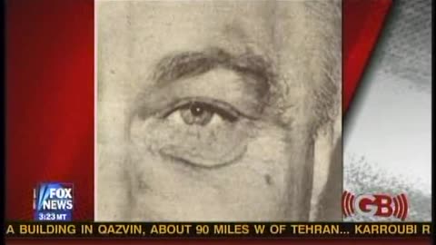 01-08-10 FDR's Secret Melanoma, Seg 3 of 7 (3.43, 3)