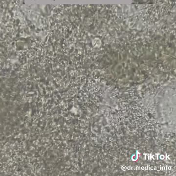 Try not bites your nails with ur teeth