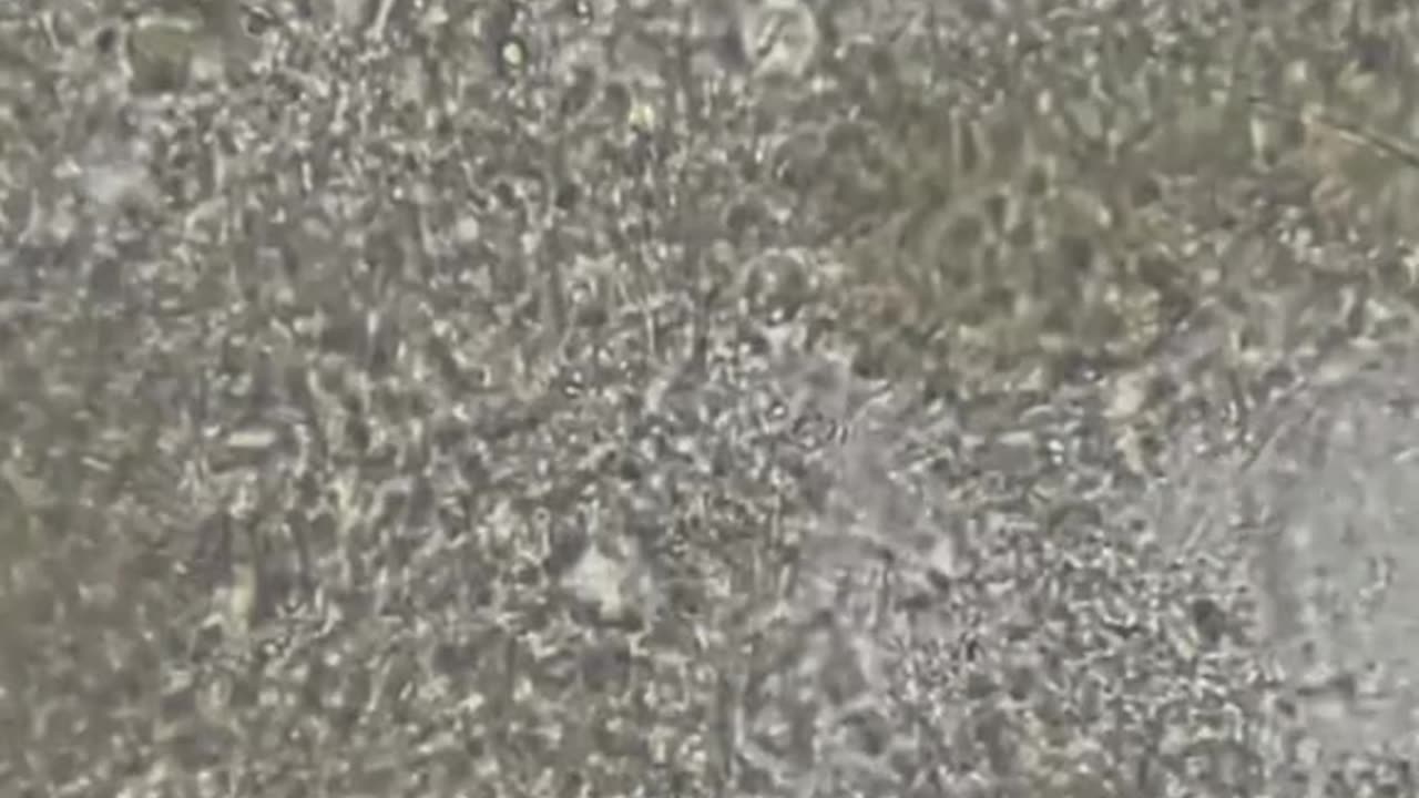 Try not bites your nails with ur teeth