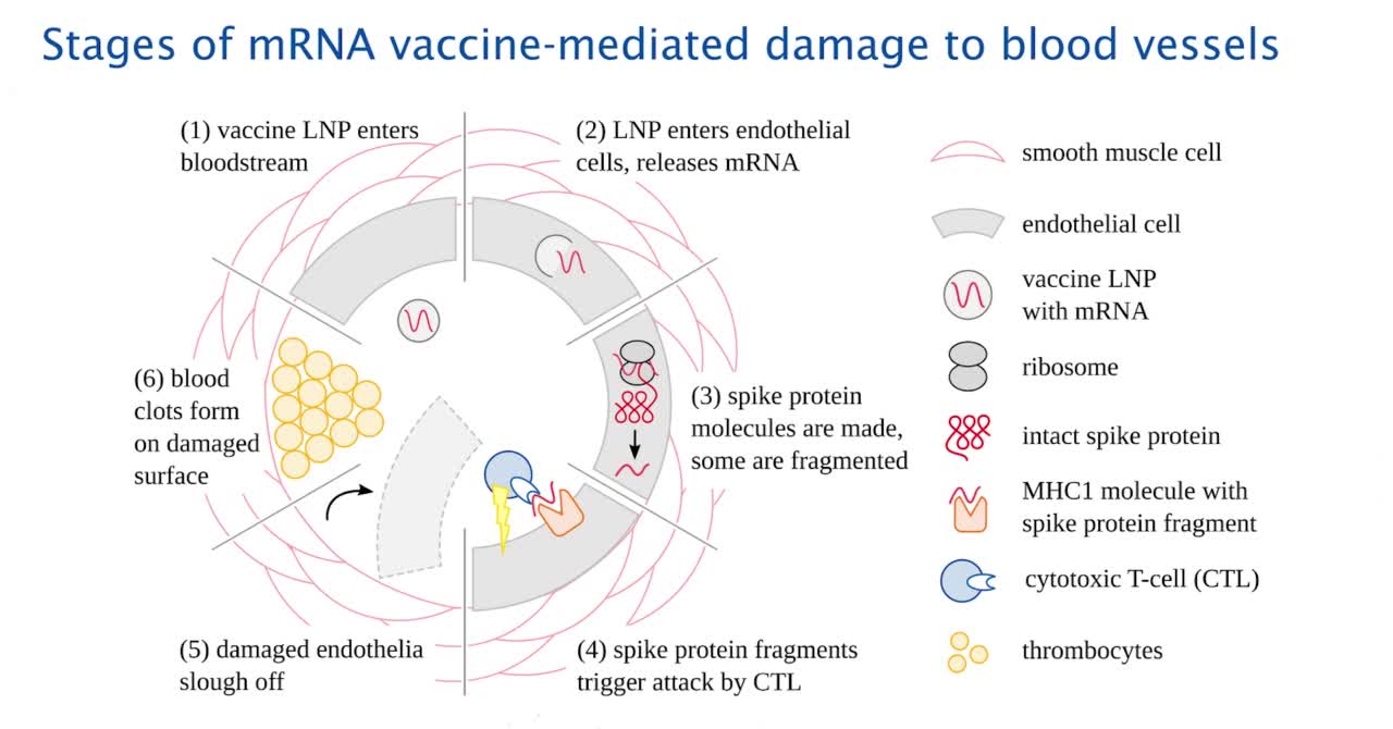 Prof. Sucharid Bhakdi Gene-based vaccination Quo Vadis