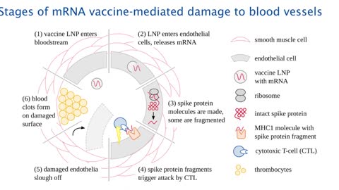 Prof. Sucharid Bhakdi Gene-based vaccination Quo Vadis