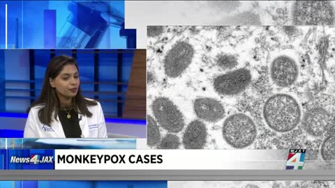 Monkeypox declared a public health emergency