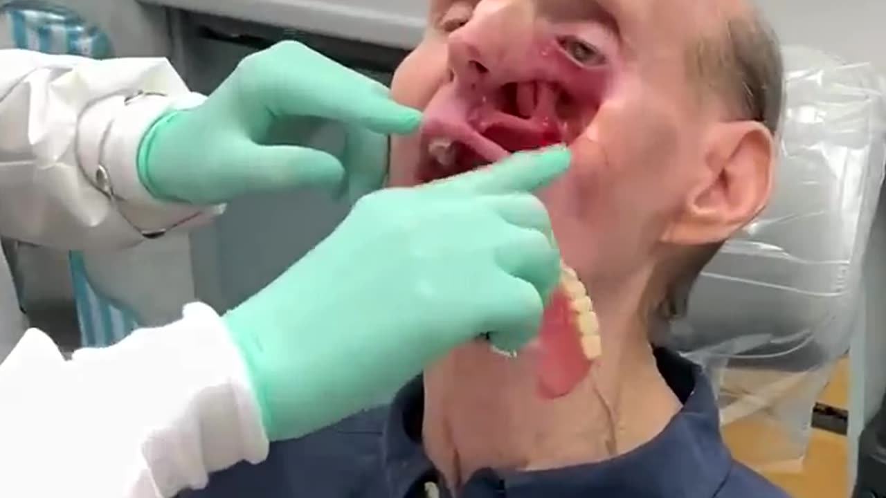 Chiropractor Helps 9/11 Responder Regain Freedom with Prosthetic Jaw and Facial Restoration