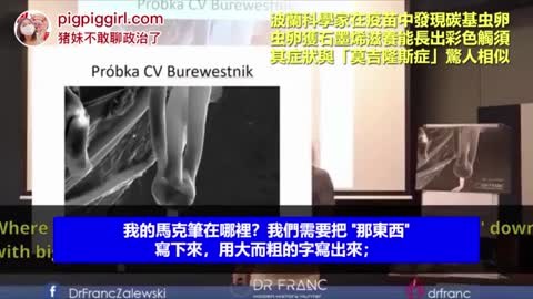 波蘭科學家在疫苗中發現碳基蟲卵，蟲卵獲石墨烯滋養能長出彩色長須