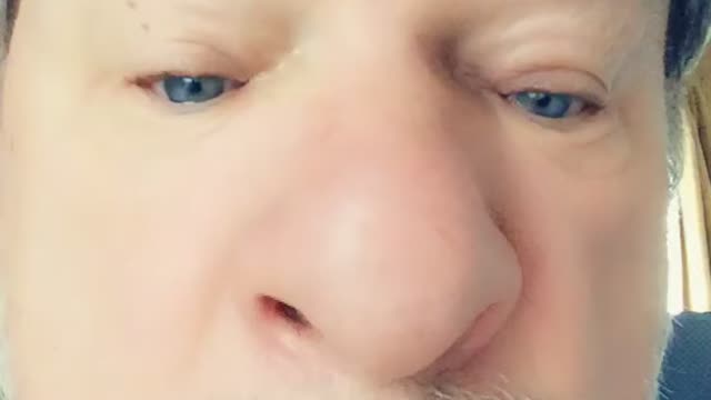 Man disputes doctor’s suggestion that his eyes are too small.