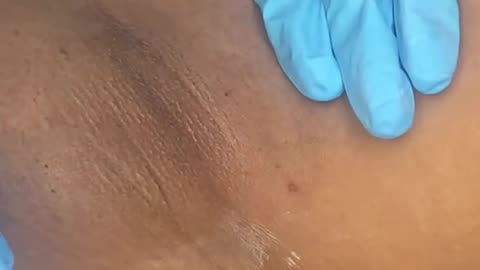 Underarm Waxing with Sexy Smooth Tickled Pink Hard Wax by @sfbbykay1