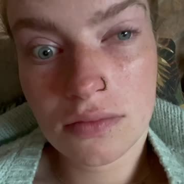 Adverse Reaction 1231