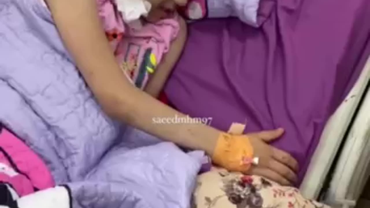 Basal skull fracture with brain damage as a result of the Israeli artillery shelling