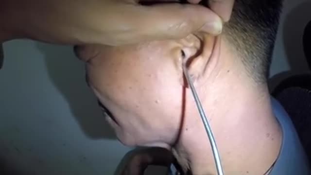 Guss whate is man ear