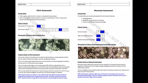 Live Blood Analysis - Platelet Aggregation