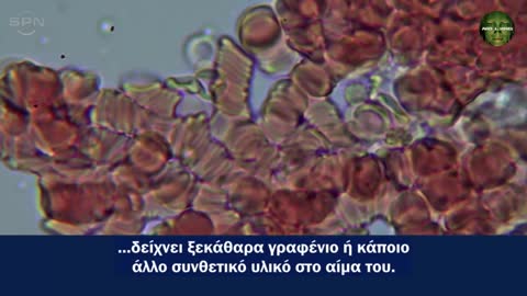 Αυτοσυναρμολογούμενα κυκλώματα δημιουργούνται σε εμβόλια Ο WiFi ίντερνετ ρούτερ το προκαλεί !!!