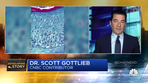 Dr. Scott Gottlieb Says Monkeypox Can Live on Objects Such as Blankets & Clothing