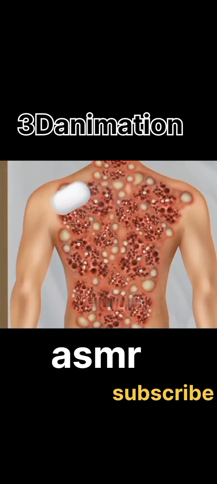 How to remove Tick in his back #anime #animation#3danimation#asmr