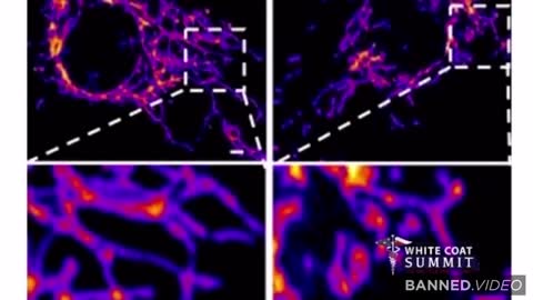 See What The Covid-19 Shots Do To Your Organs