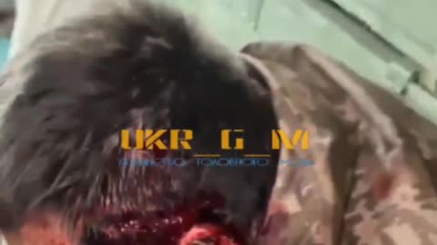 Ukrofascists continue to suffer heavy losses in killed and wounded along the entire front line
