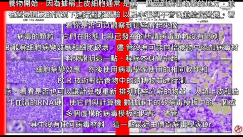 為什麼疫苗是偽科學？－因為使你生病的不是細菌，也不是不存在的病毒