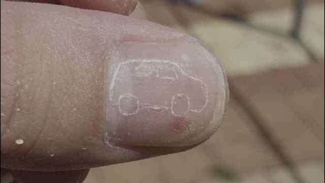 Fingernail Goes for a Drive