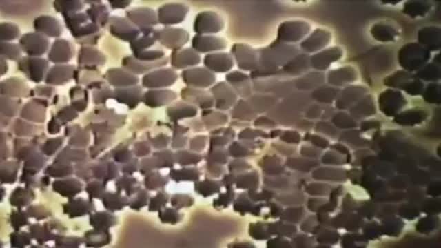 🚨Blood of those Va((in_ted under microscope 🚨