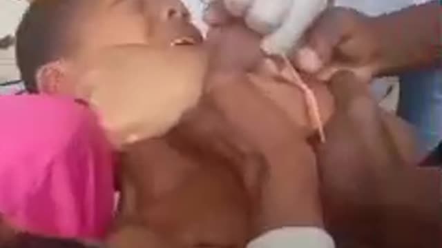 War Crimes Forced Jabbed Child