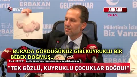 Turkish Pfizer Baby ?