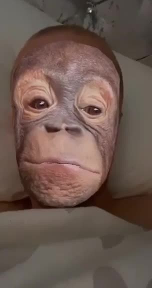 just had me monkey pox jab, very safe,feeling great...