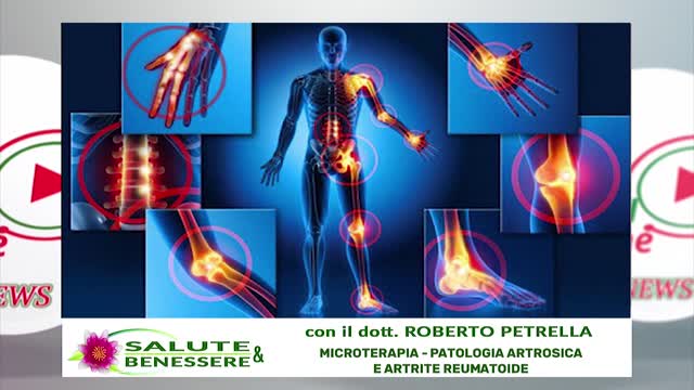 MICROTERAPIA - PATOLOGIA ARTROSICA E ARTRITE REUMATOIDE