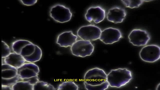 LIVE BLOOD ANALYSIS: ENDOBIOSIS Part 5