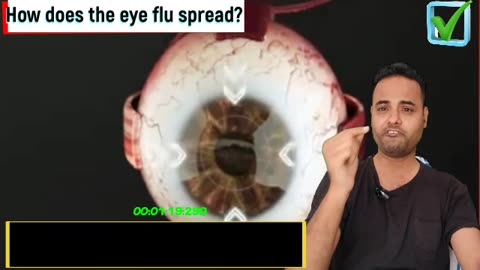 Eye flu se kaise bache