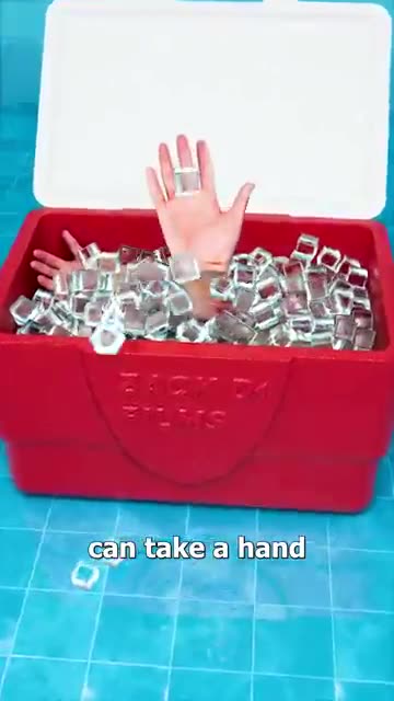 How A Hand Transplant Works ✋