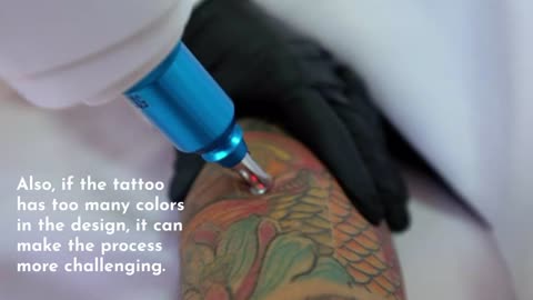 Things To Know About Large Tattoo Removal