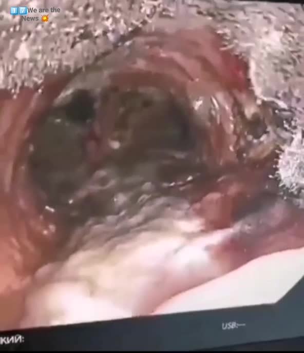 Pilzbefall - durch Maske tragen ?