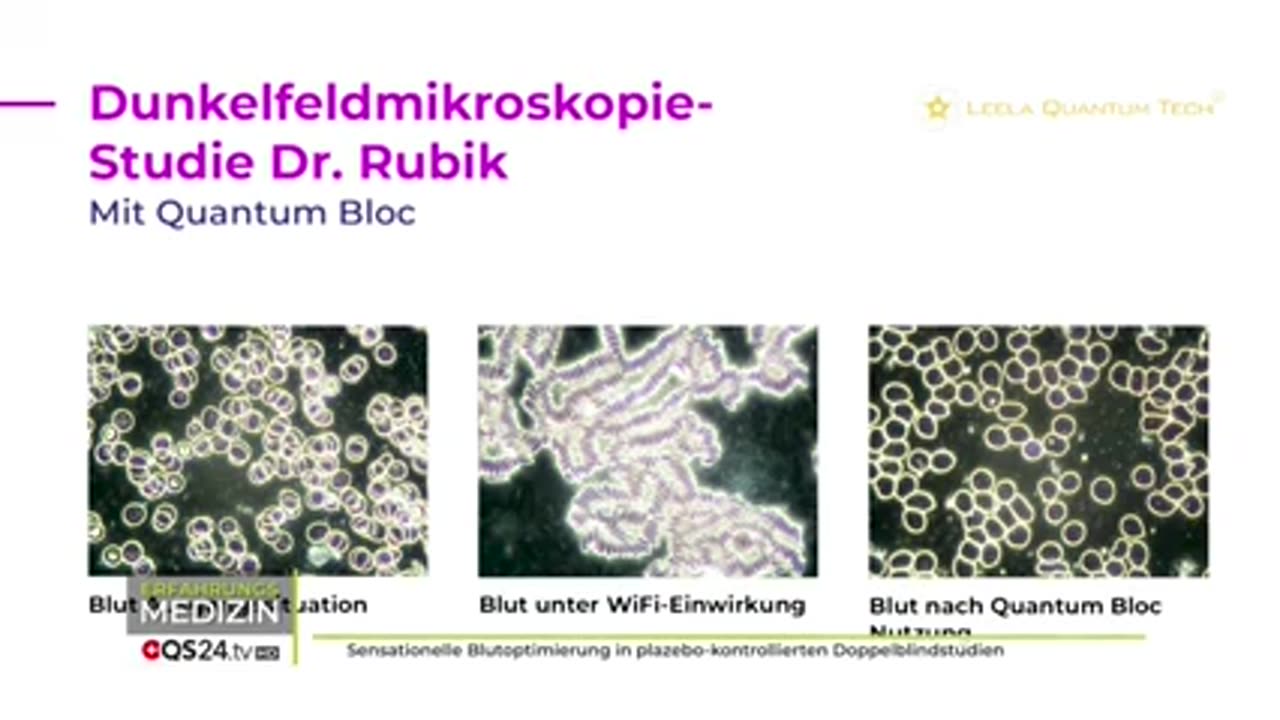 Blutverklumpung durch Wifi